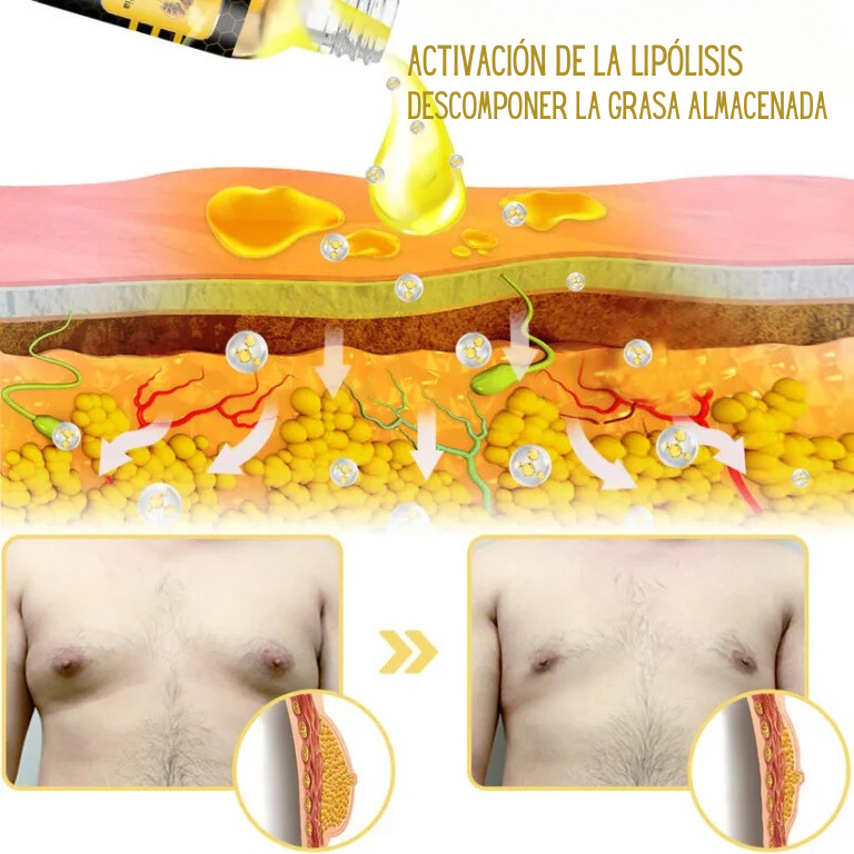 Bee venom Gynecomastia Heating Oil 15 ml (Pack of 2)